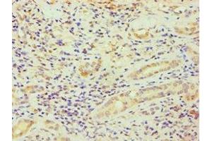 Immunohistochemistry of paraffin-embedded human kidney tissue using ABIN7164363 at dilution of 1:100 (DDX5 antibody  (AA 1-290))