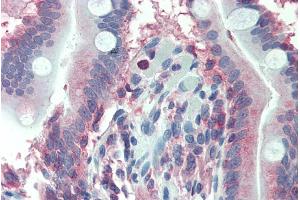 ABIN238605 (2. (LASP1 antibody  (Internal Region))