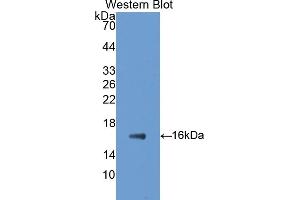 Detection of Recombinant GAD1, Rat using Polyclonal Antibody to Glutamate Decarboxylase 1, Brain (GAD1) (GAD antibody  (AA 1-97))