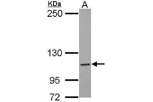 WB Image Sample (30 ug of whole cell lysate) A: MCF-7 5% SDS PAGE antibody diluted at 1:1000 (NLRC4 antibody  (N-Term))