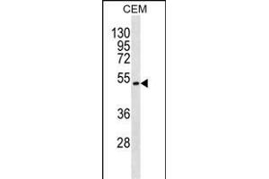 TOM1L2 Antibody (C-term) (ABIN1537379 and ABIN2850138) western blot analysis in CEM cell line lysates (35 μg/lane). (TOM1L2 antibody  (C-Term))