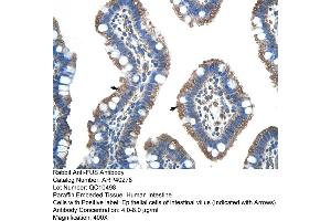 Rabbit Anti-FUS Antibody  Paraffin Embedded Tissue: Human Intestine Cellular Data: Epithelial cells of intestinal villas Antibody Concentration: 4.