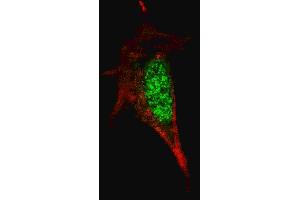 Fluorescent confocal image of SY5Y cells stained with SOX2 antibody.