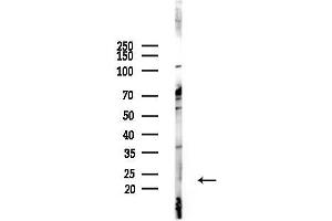 anti-RAB7, Member RAS Oncogene Family-Like 1 (RAB7L1) (pThr71) antibody