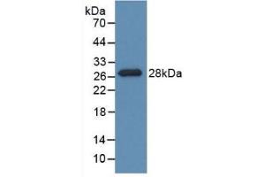 Detection of Recombinant PDXK, Rat using Polyclonal Antibody to Pyridoxal Kinase (PDXK) (PDXK antibody  (AA 35-251))