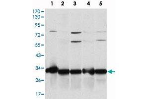 Western blot analysis using NQO1 monoclonal antibody, clone 4D12  against A-549 (1), SKNES (2), HepG2 (3), MCF-7 (4) and HeLa (5) cell lysate.