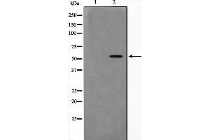 Western blot analysis on 293 cell lysate using AKT1 Antibody，The lane on the left is treated with the antigen-specific peptide. (AKT1 antibody  (C-Term))