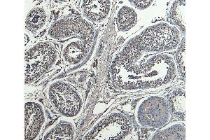 Immunohistochemistry (IHC) image for anti-Homeobox A10 (HOXA10) (Internal Region) antibody (ABIN1590026)