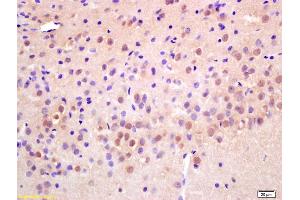 Formalin-fixed and paraffin embedded rat brain labeled with Anti-RAD21 Polyclonal Antibody, Unconjugated (ABIN706391) at 1:200 followed by conjugation to the secondary antibody and DAB staining. (RAD21 antibody  (AA 531-631))