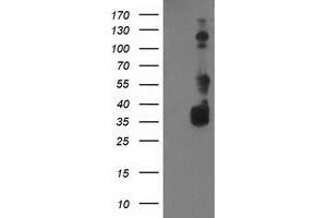HEK293T cells were transfected with the pCMV6-ENTRY control (Left lane) or pCMV6-ENTRY BAIAP2 (Right lane) cDNA for 48 hrs and lysed. (BAIAP2 antibody)