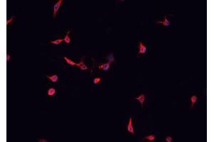 Immunofluorescence (fixed cells) (IF/ICC) image for anti-Cyclin-Dependent Kinase-Like 4 (CDKL4) (Internal Region) antibody (ABIN6260726)
