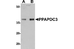 Western blot analysis of PPAPDC3 in mouse heart tissue lysate with PPAPDC3 antibody at (A) 1 and (B) 2 µg/mL. (PPAPDC3 antibody  (Middle Region))