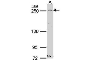 WB Image Sample (30 ug of whole cell lysate) A: Hela 5% SDS PAGE GBF1 antibody antibody diluted at 1:1000 (GBF1 antibody  (N-Term))