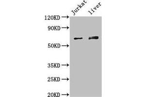 Western Blot Positive WB detected in: Jurkat whole cell lysate, Mouse liver tissue All lanes: KLHL2 antibody at 3 μg/mL Secondary Goat polyclonal to rabbit IgG at 1/50000 dilution Predicted band size: 66, 67, 57 kDa Observed band size: 66, 67 kDa (KLHL2 antibody  (AA 1-155))