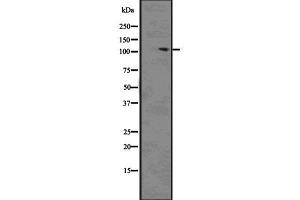 Western blot analysis of Phospho-Ack1 (Tyr857/858) using HeLa whole cell lysates (TNK2 antibody  (pTyr857, pTyr858))