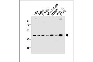 All lanes : Anti-HTR4 Antibody (N-term) at 1:1000 dilution Lane 1: Hela whole cell lysate Lane 2: Jurkat whole cell lysate Lane 3: S whole cell lysate Lane 4: MDA-MB-453 whole cell lysate Lane 5: Mouse brain lysate Lane 6: Neuro-2a whole cell lysate Lane 7: PC-12 whole cell lysate Lysates/proteins at 20 μg per lane. (Serotonin Receptor 4 antibody  (N-Term))
