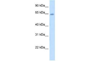 WB Suggested Anti-STS Antibody Titration:  5. (STS antibody  (C-Term))