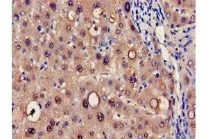 Immunohistochemistry of paraffin-embedded human liver tissue using ABIN7142154 at dilution of 1:100 (HRSP12 antibody  (AA 2-137))