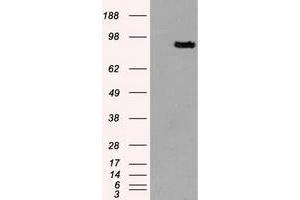 HEK293T cells were transfected with the pCMV6-ENTRY control (Left lane) or pCMV6-ENTRY PROM2 (Right lane) cDNA for 48 hrs and lysed. (Prominin 2 antibody)