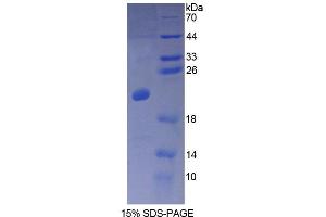 SDS-PAGE analysis of Human CALML3 Protein. (CALML3 Protein)