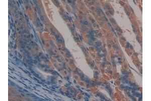 Detection of ALCAM in Mouse Stomach Tissue using Polyclonal Antibody to Activated Leukocyte Cell Adhesion Molecule (ALCAM) (CD166 antibody  (AA 28-527))