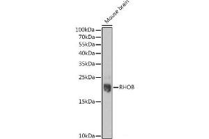 Western blot analysis of extracts of Mouse brain using RHOB Polyclonal Antibody at dilution of 1:1000. (RHOB antibody)
