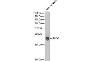 Western blot analysis of extracts of Mouse brain using RHOB Polyclonal Antibody at dilution of 1:1000.