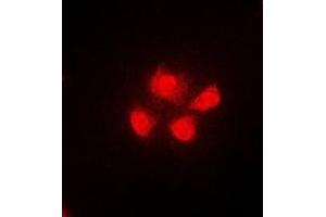 Immunofluorescent analysis of TUG staining in A549 cells. (ASPSCR1 antibody)