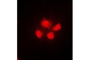 Immunofluorescent analysis of TUG staining in A549 cells. (ASPSCR1 antibody)