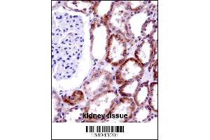 CD70 Antibody immunohistochemistry analysis in formalin fixed and paraffin embedded human kidney tissue followed by peroxidase conjugation of the secondary antibody and DAB staining.