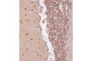 Immunohistochemical analysis of C on paraffin-embedded Human cerebellum tissue.