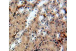 Used in DAB staining on fromalin fixed paraffin-embedded Kidney tissue (Uromodulin antibody  (AA 335-590))