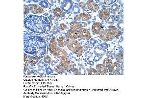Rabbit Anti-ASS Antibody  Paraffin Embedded Tissue: Human Kidney Cellular Data: Epithelial cells of renal tubule Antibody Concentration: 4. (ASS1 antibody  (C-Term))