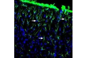 Expression of GFAP in rat brainImmunohistochemical staining of free-floating rat frozen brain sections using Anti-GFAP Antibody (ABIN7043217, ABIN7044273 and ABIN7044274), (1:2000).