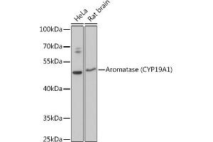 Western blot analysis of extracts of various cell lines, using Aromatase (CYP19) antibody (2684) at 1:3000 dilution. (Aromatase antibody  (AA 1-180))