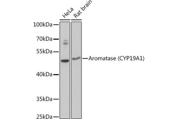 Aromatase 抗体  (AA 1-180)
