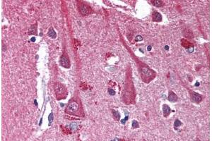 Human Brain, Cortex (formalin-fixed, paraffin-embedded) stained with CXCR4 antibody ABIN301627 at 10 ug/ml followed by biotinylated anti-mouse IgG secondary antibody ABIN481714, alkaline phosphatase-streptavidin and chromogen. (CXCR4 antibody)