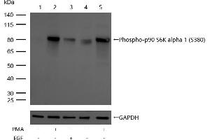 Western Blotting (WB) image for anti-Ribosomal Protein S6 Kinase, 90kDa, Polypeptide 1 (RPS6KA1) (pSer380) antibody (ABIN7606750)