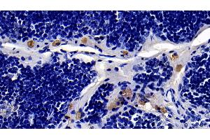 Immunohistochemistry (IHC) image for anti-Toll-Like Receptor 4 (TLR4) (AA 49-247) antibody (ABIN7432529)