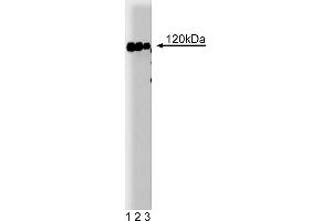Western Blotting (WB) image for anti-Cas-Br-M (Murine) Ecotropic Retroviral Transforming Sequence (CBL) (AA 595-810) antibody (ABIN967971) (CBL antibody  (AA 595-810))