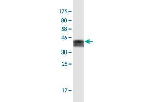 Western Blot detection against Immunogen (36. (FOXM1 antibody  (AA 702-801))