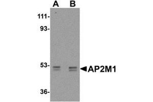 Western Blotting (WB) image for anti-Adaptor-Related Protein Complex 2, mu 1 Subunit (AP2M1) (C-Term) antibody (ABIN1030240) (AP2M1 antibody  (C-Term))