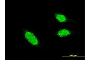 Immunofluorescence of monoclonal antibody to BLID on HeLa cell.