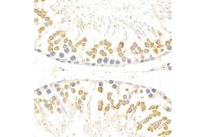 Immunohistochemistry analysis of paraffin-embedded rat testis using Torsin A (ABIN7075942) at dilution of 1: 800 (TOR1A antibody)