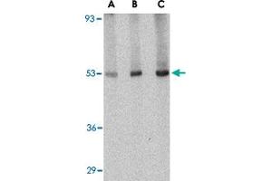 Western blot analysis of CRLF2 in human liver tissue lysate with CRLF2 polyclonal antibody  at (A) 0.