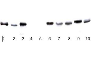 Image no. 4 for anti-Glyceraldehyde-3-Phosphate Dehydrogenase (GAPDH) antibody (ABIN284439) (GAPDH antibody)