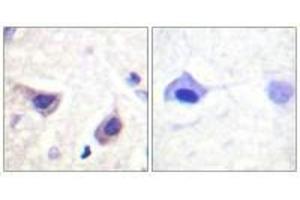 Immunohistochemistry analysis of paraffin-embedded human brain tissue using JAK3 (Ab-785) antiobdy. (JAK3 antibody  (Tyr785))