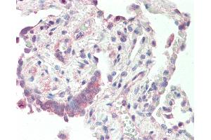 Human, Lung: Formalin-Fixed Paraffin-Embedded (FFPE). (DEGS1 antibody  (N-Term))