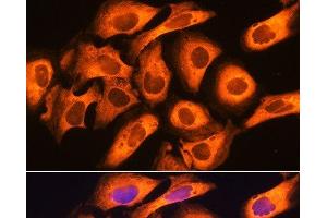 Immunofluorescence analysis of U20S cells using RIG-I / DDX58 Polyclonal Antibody at dilution of 1:100. (DDX58 antibody)