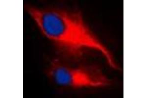 Immunofluorescent analysis of LCK (pY393) staining in MCF7 cells. (LCK antibody  (pTyr393))